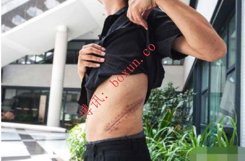 越南警方拦截非法卖肾行为：青年受网络诱骗欲赴柬埔寨，被及时解救