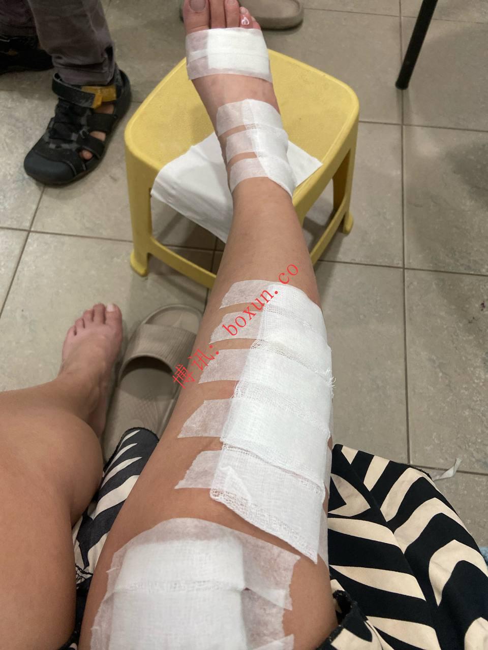 斯里兰卡科伦坡车祸经历引热议：冷漠急诊室与陌生人的温暖援手形成强烈反差