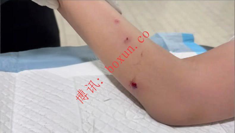 中国籍女游客在马来西亚沙巴亚庇疑遭气枪袭击 旅游安全引发关注