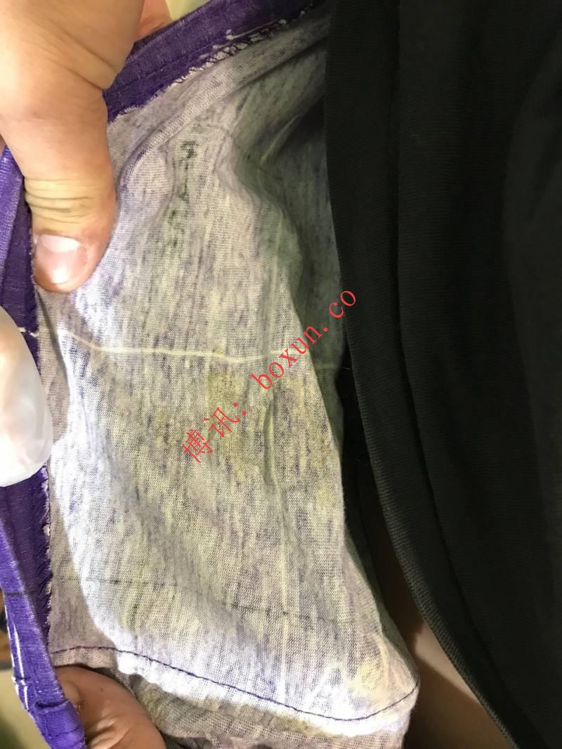 #网友分享 我是一名医生 近期超多来看病的。想分享一下。