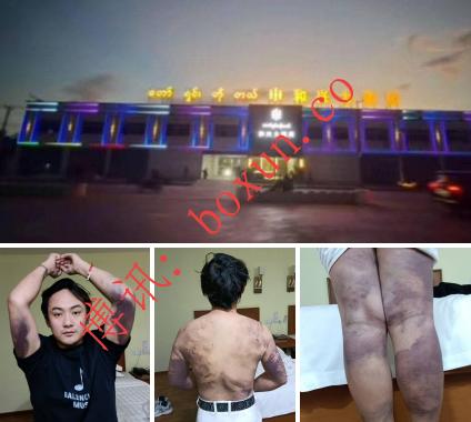 缅甸知名歌手遭诈骗集团绑架勒索 木姐再曝跨境犯罪黑幕