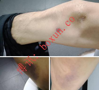 群友投稿揭露柬埔寨多地赌场与园区黑幕：涉非法拘禁、暴力看押与人口贩卖指控